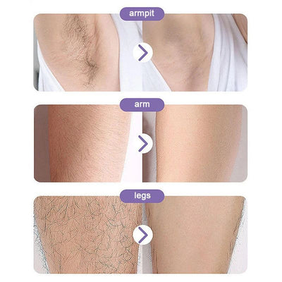 Crystal Hair Remover – Portable Magic Epilator for Men & Women, Full Body Use